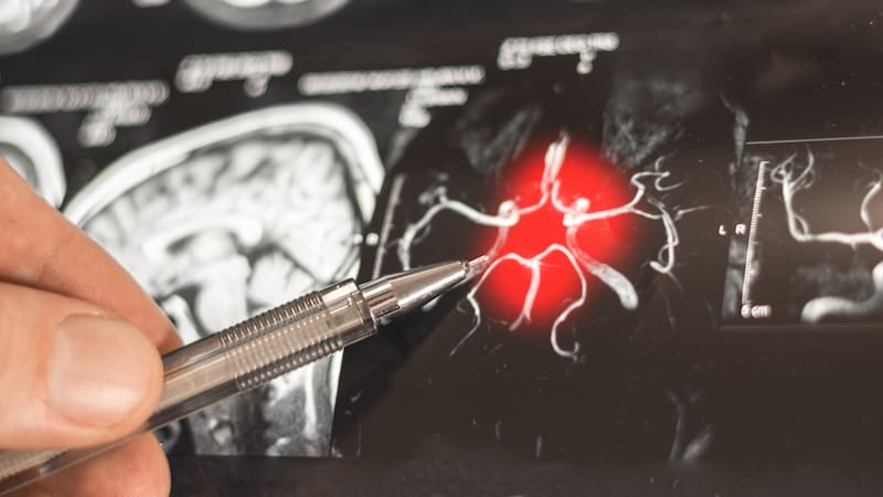 Alzheimer | Descubren una molécula que reprograma las defensas del cerebro y mejora la memoria