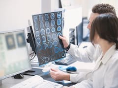 Atención Alzheimer: el hallazgo argentino que puede cambiar para siempre la manera de detectarlo