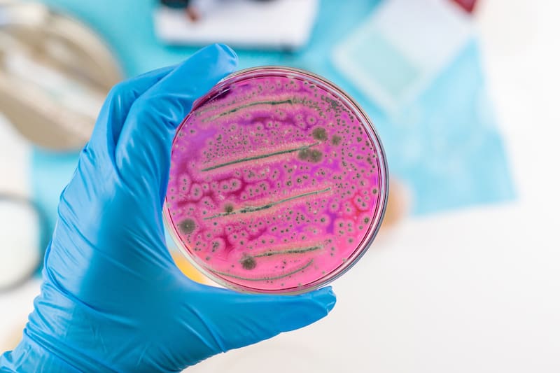 Microscopía de bacterias