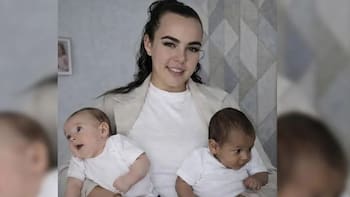 Impactante caso en Brasil: una mujer dio a luz gemelos que no comparten el mismo padre biológico