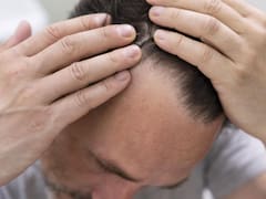 Este Gobierno quiere que la salud pública cubra los tratamientos contra la caída del cabello por ser una “cuestión de supervivencia”