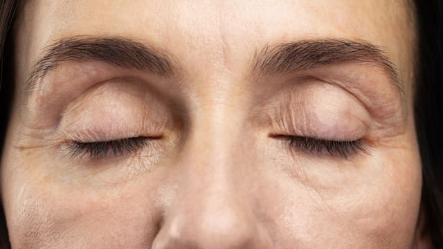 Cómo reducir las bolsas debajo de los ojos: este es el truco casero que recomiendan los expertos