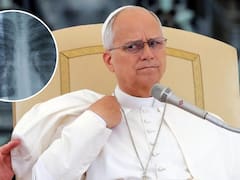 Qué es un nódulo pulmonar y qué tan grave es la operación al Papa León XIV