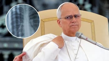 Qué es un nódulo pulmonar y qué tan grave es la operación al Papa León XIV