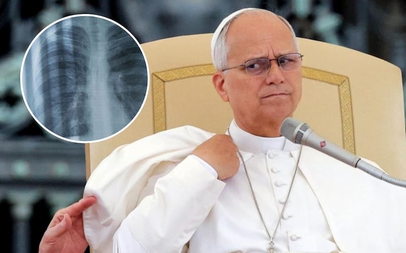 La salud del papa León XIV es una de las principales preocupaciones globales.