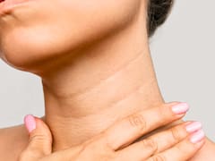Cómo eliminar las arrugas del cuello y mejorar la piel de la cara: fácil, rápido y en casa