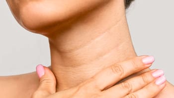 Cómo eliminar las arrugas del cuello y mejorar la piel de la cara: fácil, rápido y en casa