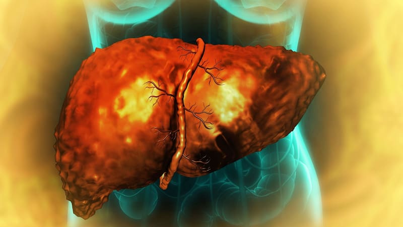 Expertos advierten de los riesgos que pueden causar hígado graso. Fuente: Archivo.