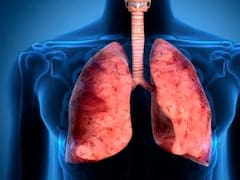 El estudio médico que puede prevenir la muerte por cáncer de pulmón: se salvarían 30.000 pacientes al año