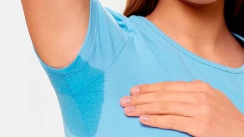 Qué es la hiperhidrosis, cómo afecta la rutina y qué alternativas existen
