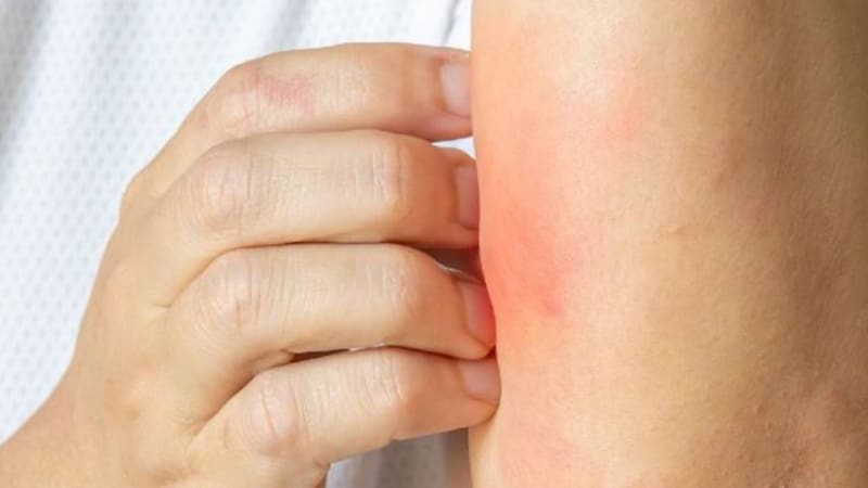 Qué significa rascarse mucho la piel, según la psicología