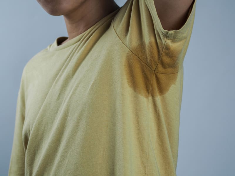 Qué significa tener hiperhidrosis y cómo afecta en la rutina