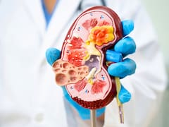 Prohibido por nutricionistas: estos son los tres alimentos de consumo diario que afectan a los riñones y nadie lo sabe