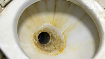 Cómo borrar para siempre el sarro del inodoro con un sólo ingrediente: elimina las manchas amarillas y queda como nuevo