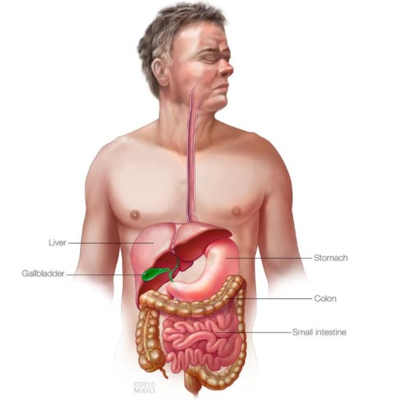 El SIBO, o sobrecrecimiento bacteriano en el intestino delgado, ocurre cuando aumenta de forma anormal la cantidad de bacterias en esta zona del sistema digestivo. (Foto: Mayo Clinic)