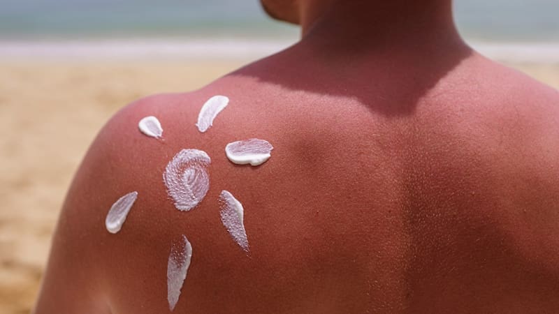 El "tatuaje" aparece por el contraste entre la piel quemada —que se torna roja e inflamada— y la piel protegida. Sin embargo, lo que puede parecer un desafío divertido de Tik Tok es, en realidad, un daño gravísimo e irreversible para la salud.