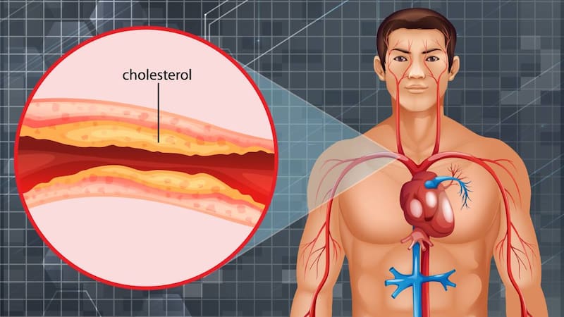 La alimentación es clave para optimizar los niveles de colesterol.