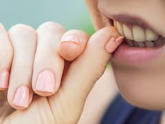 El peor hábito de todos: comerse las uñas puede traer graves consecuencias para la salud