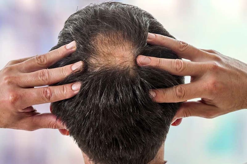 Este truco es un remedio casero que se recomienda para el cuidado del cabello.