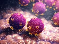 Alerta sanitaria en el continente | Advierten rebrote de una enfermedad histórica: ya son más de 7,000 infectados y hay decenas de muertos