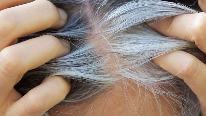 Esta vitamina es clave para cuidar la salud capilar.