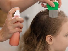 Regreso a clases sin piojos y liendres: cómo lavar la cabeza para que no se peguen los piojos en la escuela
